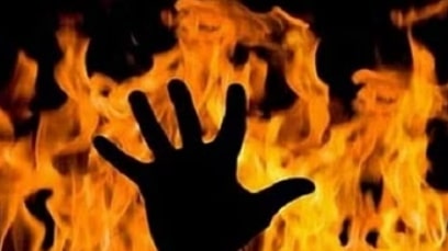 Ujjain news :-जेके सीमेंट फैक्ट्री काम करने वाले कर्मी की जलने से मौत, पुलिस मर्ग कायम कर जांच में जुटी